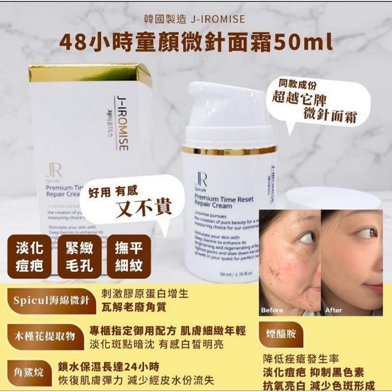 韓國 J-IROMISE 48小時童顏微針面霜50ml