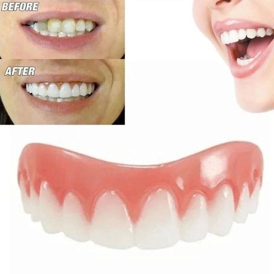 smile 矽膠模擬牙齒牙套 上排牙貼(亮白色) 上排牙套 美白牙貼  正畸牙齒 矽膠器 微笑假牙 護齒器 假牙護理