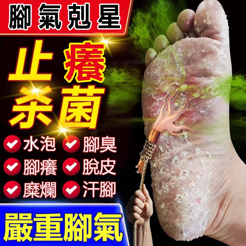 【腳不再臭】香港腳 腳臭 腳氣 腳脫皮 腳癢 腳氣救星 抑菌止癢 足爽 香港腳噴劑 腳臭治療 腳氣偏方