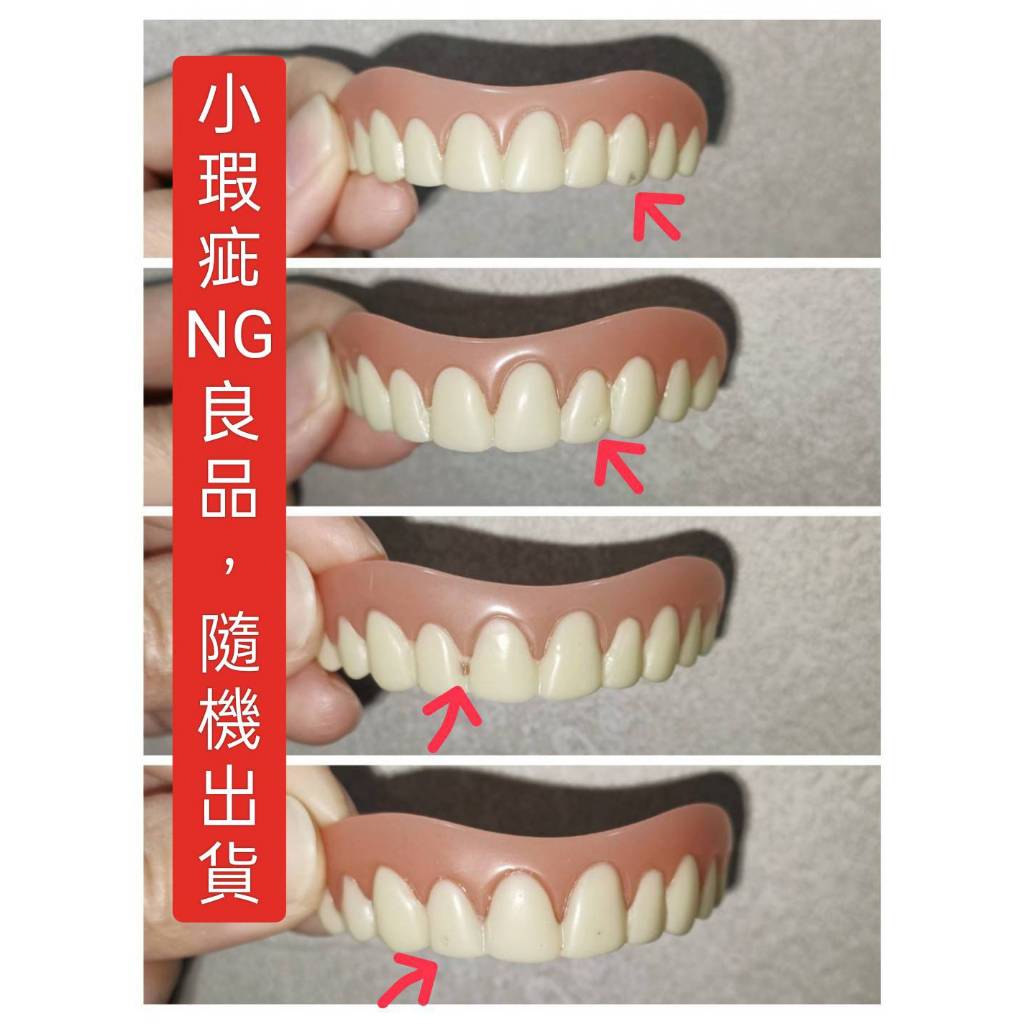 smile 上排牙貼(自然色) 矽膠假牙貼片 矽膠美齒貼 臨時假牙 美齒貼 仿真牙齒 仿真牙套 老人假牙 牙縫遮蓋