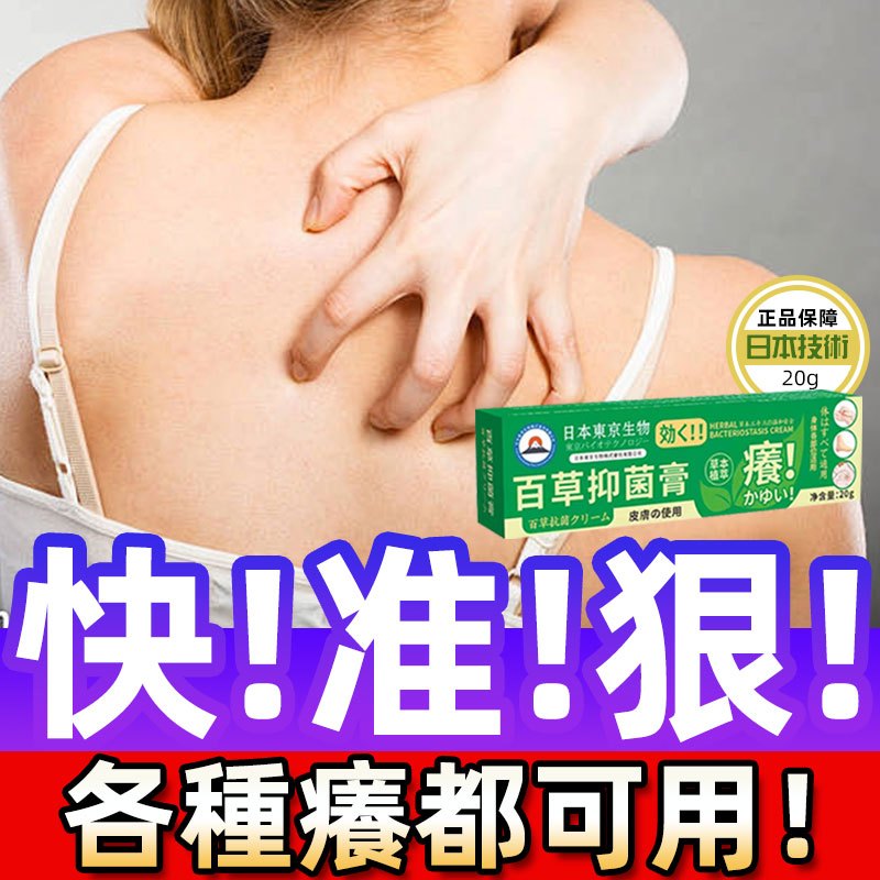 【止癢救星】濕疹乳膏皮膚瘙癢真菌皮炎止癢膏蚊蟲叮咬青草膏皮膚瘙癢百草膏身上幹癢紅疙瘩蕁麻疹修護膏