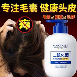 新客減20🌟 藥局同款二硫化硒去屑止癢洗髮精 控油 清爽 去屑 止癢 去頭油 控油洗髮精 去屑洗髮精 頭皮洗髮精 洗髮水