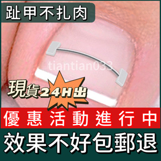 ✨桃園出貨✨記憶迴彈鎳鈦鋼絲甲溝嵌甲矯正器正甲貼片腳趾甲往肉裡長指甲紮肉 凍甲矯正器 卷甲矯正器 指甲矯正 嵌甲正甲