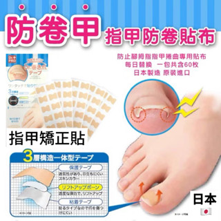 凍甲矯正 免膠水正甲貼 嵌甲貼 腳趾甲 甲溝炎 捲甲 腳趾甲貼片 預防凍甲 美甲腳趾 肉包甲糾正 糾正指甲免膠水正甲貼
