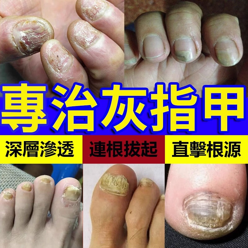 灰甲淨的價格推薦 - 2024年5月| 比價比個夠BigGo
