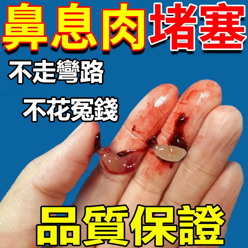 【鼻炎息肉】鼻炎噴劑息肉堵塞不通氣過敏性鼻炎噴霧鼻塞打噴嚏鼻过敏流鼻涕噴鼻劑鼻炎鼻癢鼻塞反復通鼻子急慢性鼻炎舒緩呼吸暢通