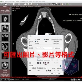 RadiAnt Dicom Viewer 2025中文dcm醫學ct影像看片閱片工具永久版