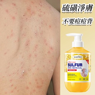 硫磺沐浴乳 止癢沐浴乳 沐浴精 沐浴露500ml硫磺有效清潔 溫和清潔 香水沐浴乳嫩滑肌膚止癢清雅香氣