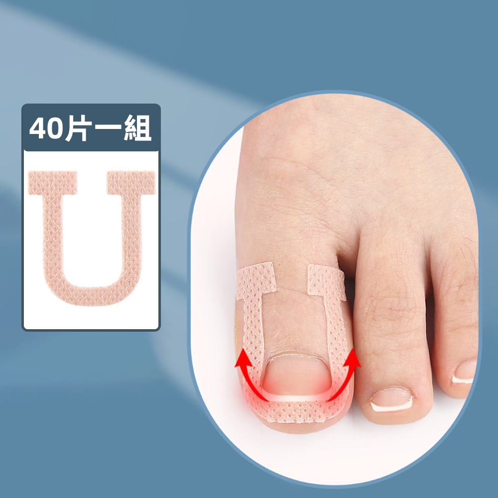 [40片組] 正甲貼 嵌甲貼片 腳趾甲貼片 甲溝炎 凍甲 嵌甲 甲溝 卷甲