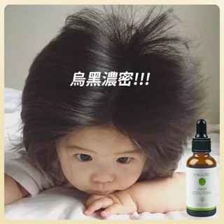 頭髮護理液 生薑精華液 養髮精華 頭皮護理營養液 脫髮 頭髮保養 髮際線 濃密髮際線 發縫 頭部精華