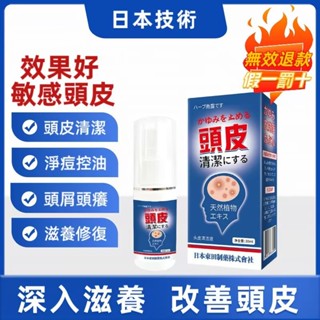 正品正品頭皮清潔劑 抑菌噴劑 清潔頭皮 頭皮保養 抑菌止癢 頭皮屑頭皮毛囊炎噴劑 頭皮調理液 頭皮止癢液