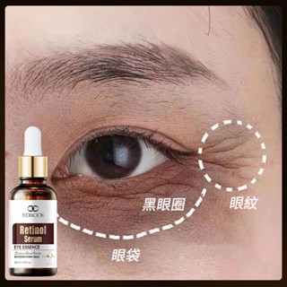 視黃醇眼部精華液 黑眼圈眼袋眼紋 熬夜眼部精華油 滋潤保濕 脂肪粒魚尾紋熊貓眼泡泡眼 眼部護理精華30ml