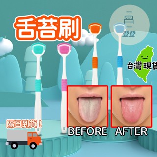 【臺灣現貨🔥】舌苔清潔器 刮舌苔 舌苔刷 舌頭清潔 刮舌器 刮舌苔器 刮舌器 舌苔 口腔清潔 刮舌苔板 舌頭清潔刷