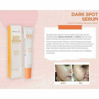 SERUM MSGLOW LUMINOUS, SeRum acne, serum darkspot ready