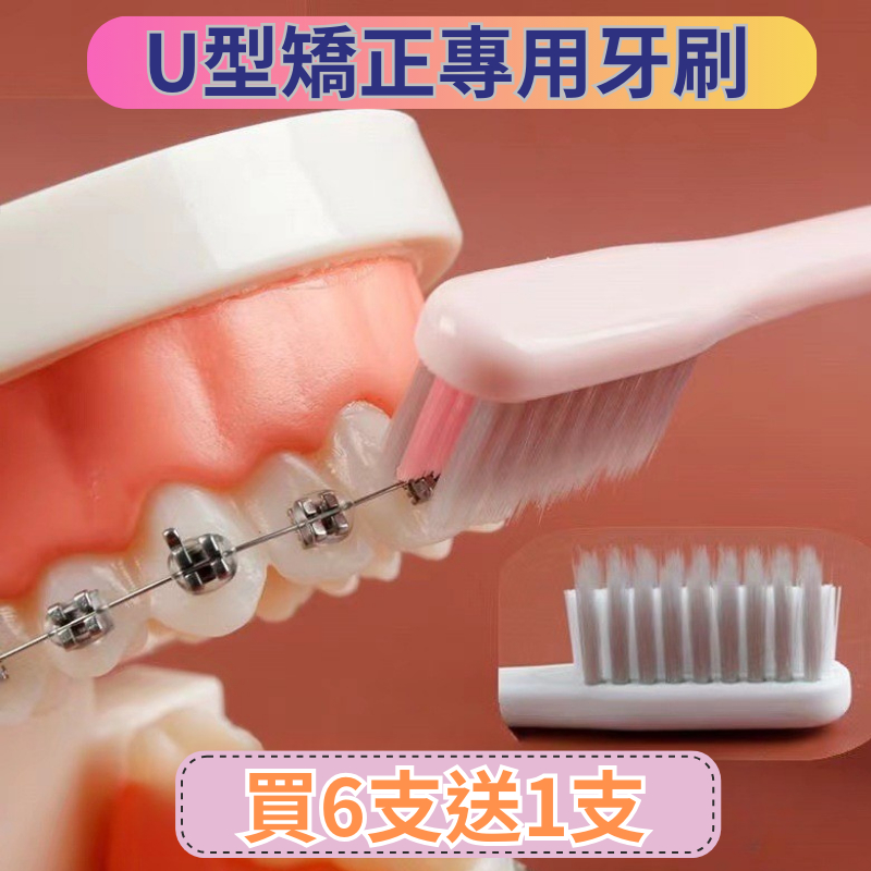 【買6支送1支】 U型矯正牙齒專用牙刷 凹型矯正牙刷 鋼絲牙套專用牙刷 矯正牙齒牙刷 矯正牙齒清潔刷