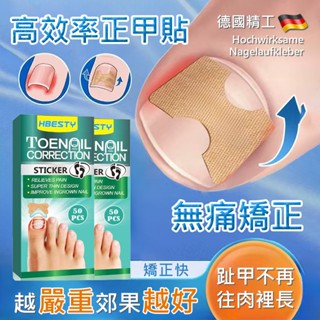 臺灣現貨✨德國修甲溝炎矯正神器 改正器正甲貼片 修凍甲貼 腳趾甲貼片美甲工具 腳趾甲專用矯正器貼片 指甲長肉裡腳拉拉貼