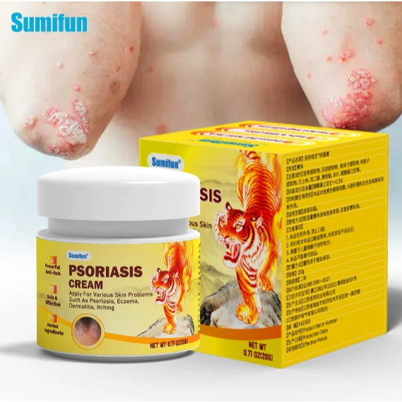 Sumifun癬霸膏 Psoriasis Cream皮膚護理霜 濕毒清軟膏~濕疹膏.皮炎.濕疹.皮膚膏 皮膚瘙癢 皮膚癢