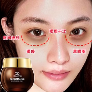 【臺灣現貨】視黃醇眼霜35g 熬夜修護眼霜 提亮 緊緻 黑眼圈 眼紋眼部護理 補水保濕 眼部精華