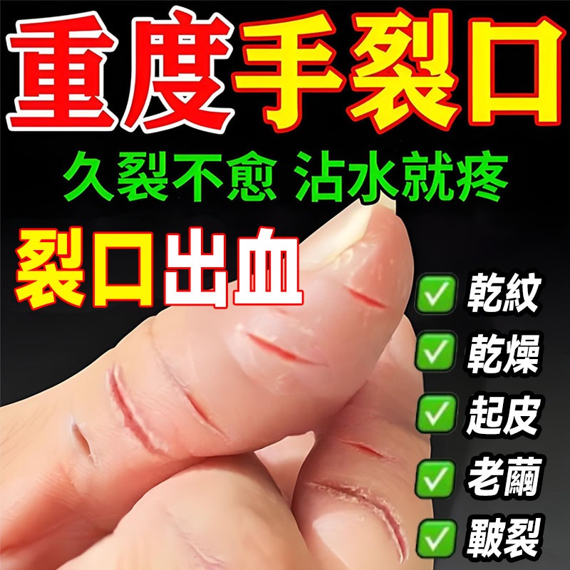 保濕乾裂膏👣日本防凍瘡膏腳跟龜裂膏富貴手救星凍傷膏手足龜裂保濕滋養龜裂手足保濕防護護手霜腳跟防裂滋潤肌膚腳後跟脫皮防凍瘡
