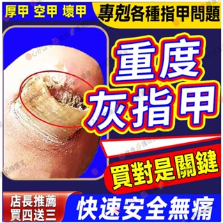 日本灰指液 指甲修復液 灰指指甲 護甲油 凍甲 厚甲 增厚靚甲 軟甲 凹凸不平 灰趾甲指甲保養 灰指甲專用液