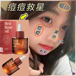 爆款推薦🔥保濕精華液 精華 精華油 臉部精華油 角鯊烷 美白精華液 玫瑰油 痘痘 黑頭 粉刺 皺紋 修復 溫和好吸收