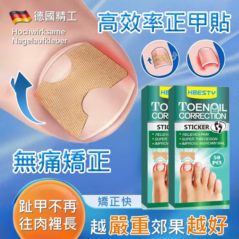 台灣出貨 德國凍甲專用 凍甲矯正貼 修甲溝炎正甲貼片 指甲長肉裏腳拉拉貼 嵌甲捲甲卷甲分離神器 腳趾甲紮肉貼片美甲工具