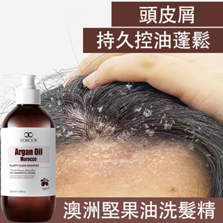 止癢洗髮精 抗屑洗髮精 洗髮乳 止癢抗屑 控油 草本 頭皮調理 頭皮屑 柔順蓬鬆 減少乾枯 強健豐盈 護髮