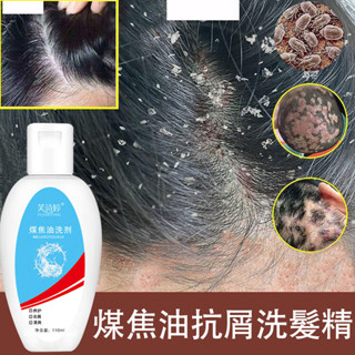 煤焦油抗屑洗髮精 止癢洗髮精 控油洗髮精 抗屑止癢 清爽控油 柔順蓬鬆 頭皮調理 草本配方 強健豐盈 秀髮護理