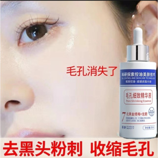 救救毛孔~！毛孔精華液 原液 精華液 控油補水保濕 收縮毛孔 黑頭 粉刺調理 毛孔緊緻精華液 毛孔細緻精華液 毛孔收縮液