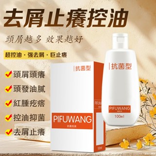 毛囊清潔洗髮水 二硫化硒頭皮除蟎 毛囊炎 去屑止癢洗髮精 蓬鬆洗護洗髮精 止癢洗髮水 控油洗髮水