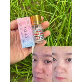 現貨💥gel nốt ruồi -mụn thịt -tàng nhan