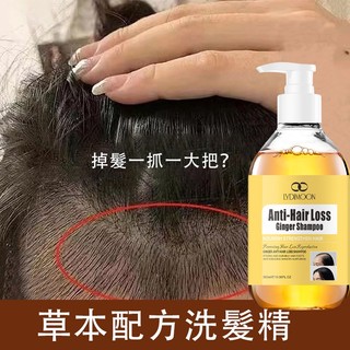 🔥台灣出貨🔥生薑洗髮精 控油洗髮精 養髮洗髮精 300ml 強健髮根 滋養頭皮 控油蓬鬆植物養