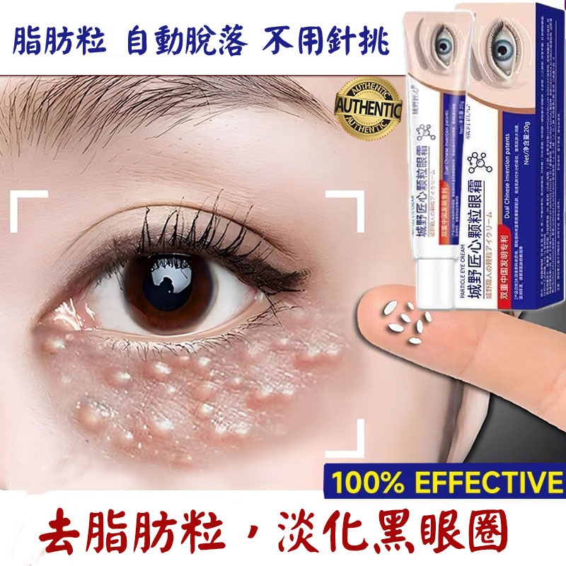 膠原蛋白玻尿酸眼霜 眼袋霜 去脂肪粒 黑眼圈霜 眼部精華 緊致眼霜 熬夜修護 眼部油脂粒護理 補水保濕 抗初老 淡化細紋