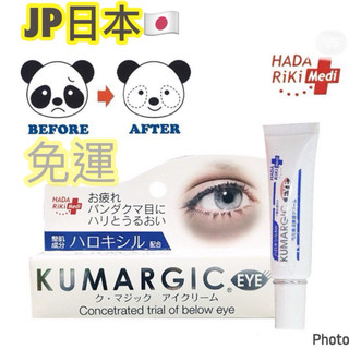 限時特價!)日本 #KUMARGIC EYE 黑眼圈 眼周修護精華 熊貓眼 20G （DX 加強版）