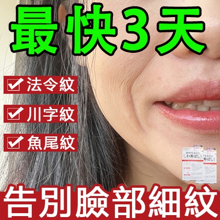 日本熱賣🔥法令紋貼 細紋貼 川字紋貼 魚尾 眼膜 法令紋 皺紋貼 抬頭紋 臉貼 黑眼圈眼膜 抬頭紋貼 額頭貼 美容貼