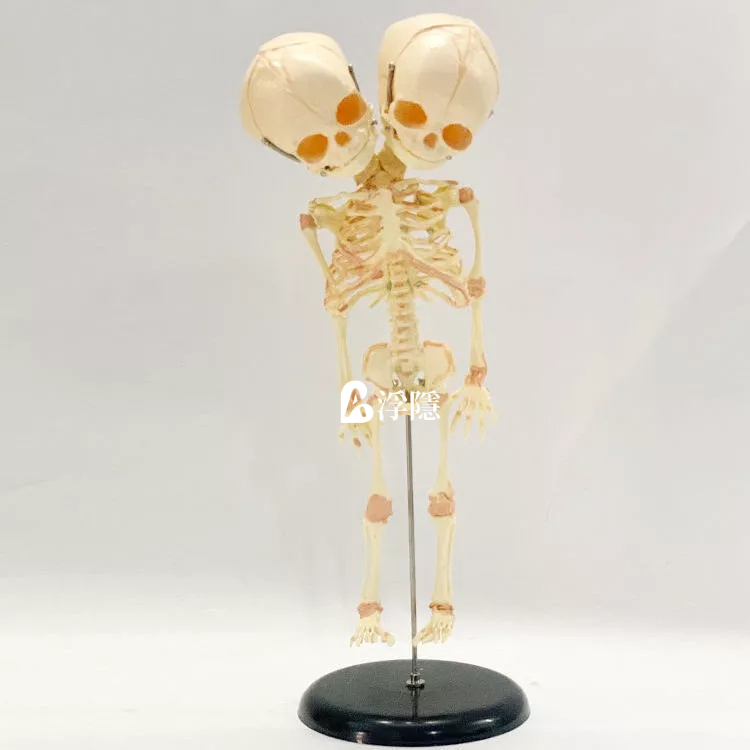 現貨 熱賣 人體嬰兒骨骼模型雙頭胎兒頭骨畸形嬰兒人骨架演示教具人骨架骷髏 人體模型 器官模型 詳細 標註 教學模具