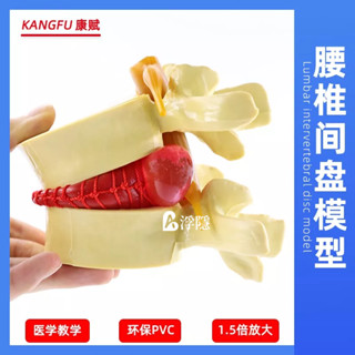有貨熱賣 腰椎放大腰椎間盤受壓演示模型人體脊柱脊椎骨病理演示關節醫學用 人體模型 器官模型 詳細 標註 教學模具