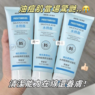 臺灣現貨🔥水楊酸潔顏乳 控油洗面奶 痘痘洗面奶 去黑頭粉刺 深層清潔 潔面乳 洗面奶 保濕洗面乳 抗痘洗面 淨白洗面乳