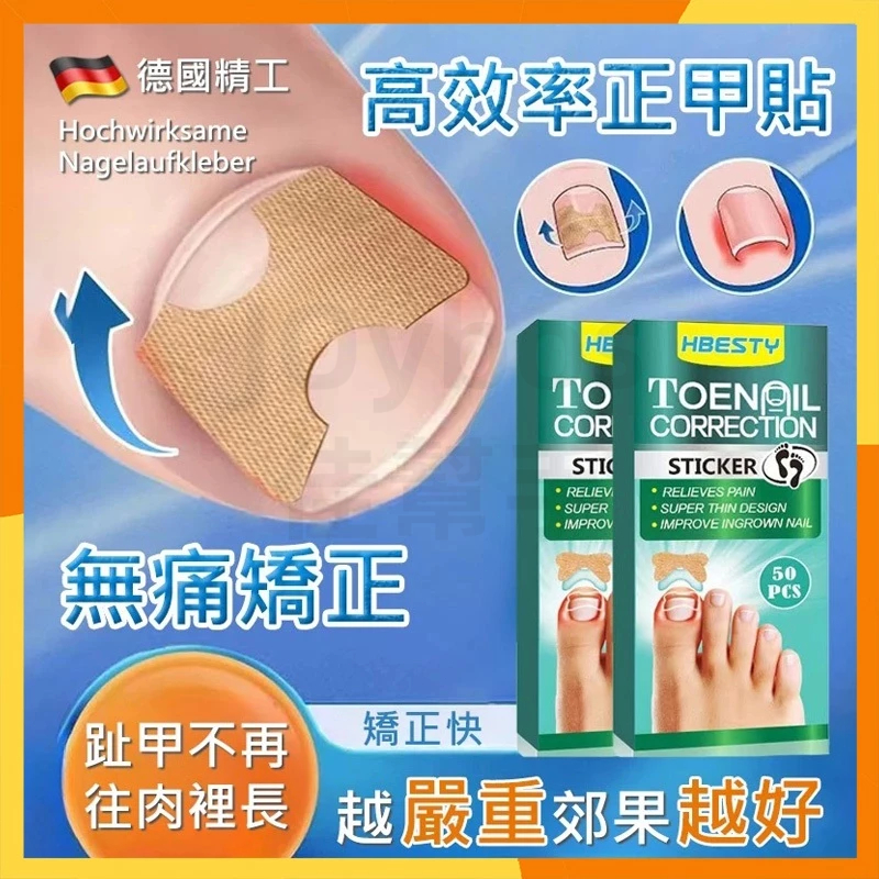 【現貨隔日達】德國正版正甲貼片 專業甲溝炎矯正神器 指甲長肉裏腳拉拉貼 嵌甲墊捲甲卷甲 修指甲剪刀 腳趾甲貼片美甲工具