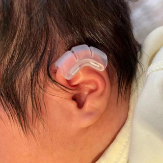 新生兒耳朵矯正器耳朵矯正器嬰兒貼耳廓貼糾正塑形耳輪定型牽引器6.25